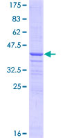 12.5% SDS-PAGE Stained with Coomassie Blue.